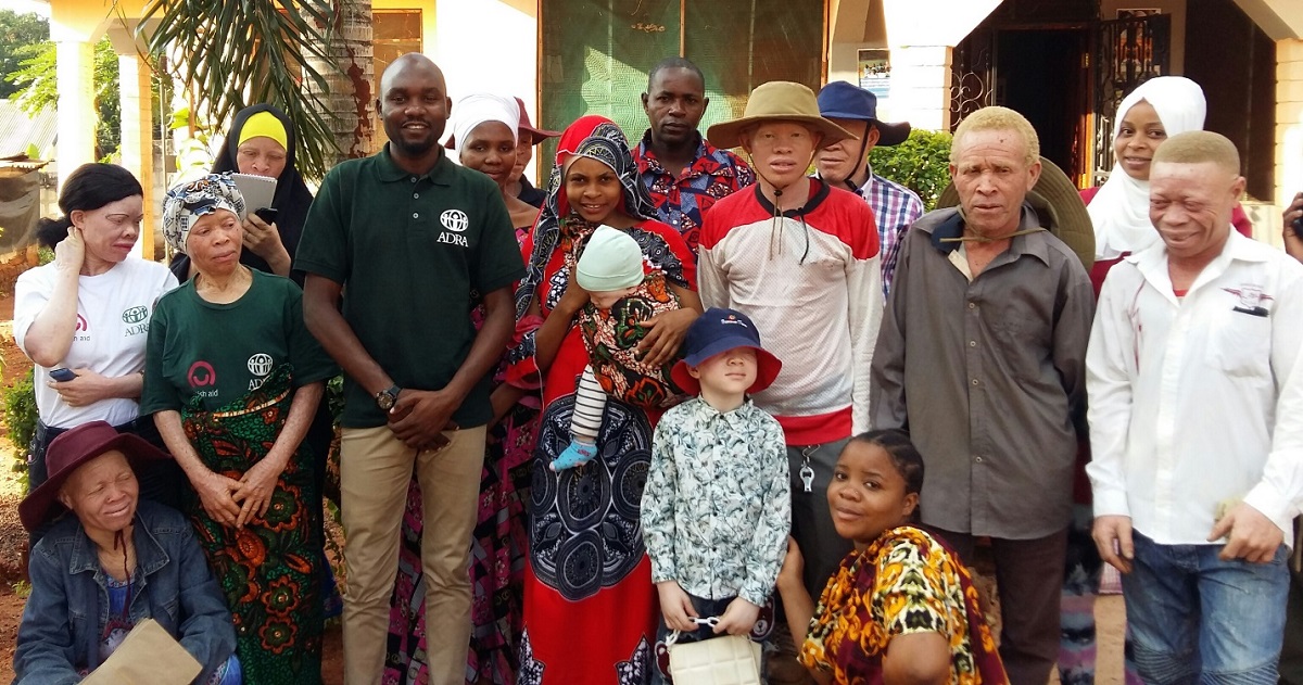 Wsparcie osób z albinizmem w Tanzanii